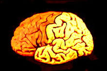 cerebro.jpg